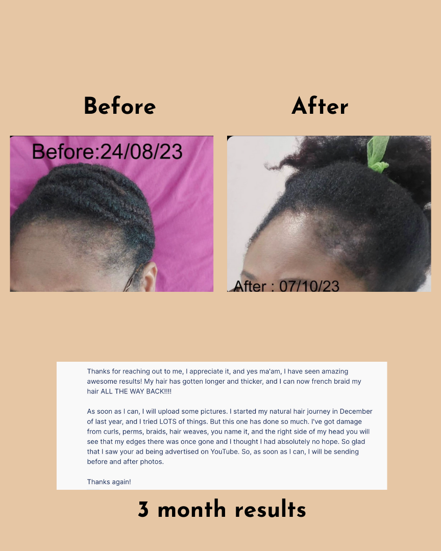 GoGrow Hair Elixir (6 Bottles)