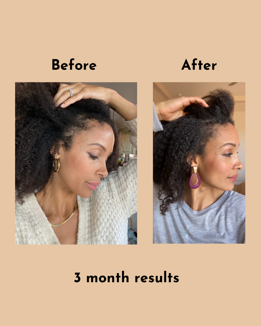 GoGrow Hair Elixir (3 Bottles)